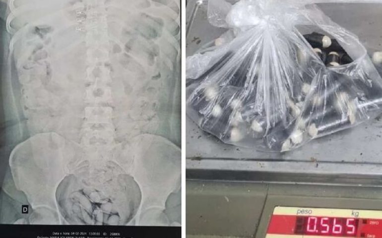 Homem foi levado para um hospital para retirar a droga - Crédito: Reprodução / Folha MS