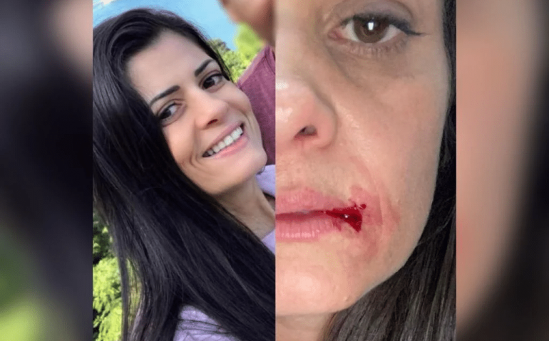 MULHER AGREDIDA PELO MARIDO TENENTE DO EB NO RIO