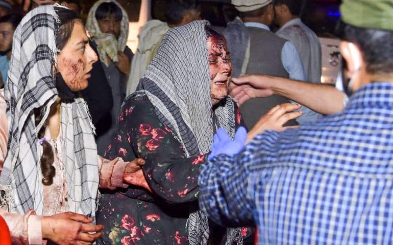 EDITORS NOTE: Graphic content / Wounded women arrive at a hospital for treatment after two blasts, which killed at least five and wounded a dozen, outside the airport in Kabul on August 26, 2021. (Photo by Wakil KOHSAR / AFP)