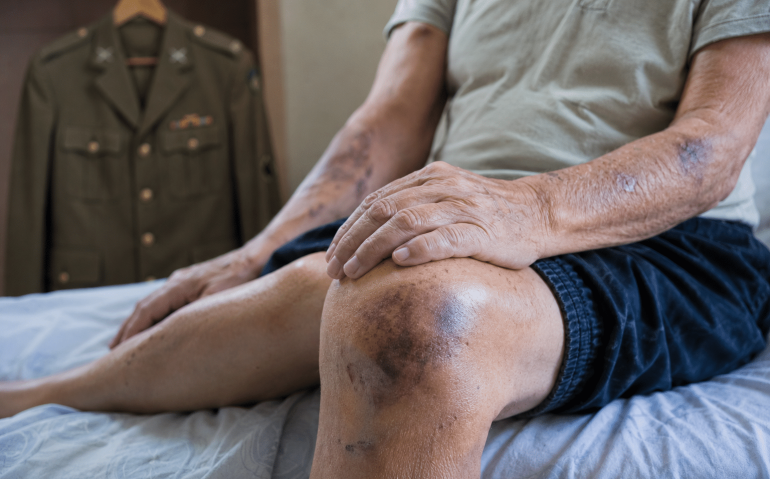 Militar aposentado agredido (Imagem ilustrativa, gerada por IA)